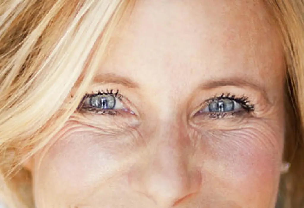 Dank HYLO-VISION® SafeDrop® Gel strahlen die zuvor trockenen Augen einer Frau wieder.