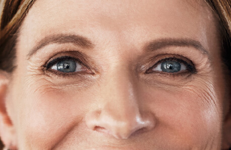 Mit HYLO-VISION® HD konnte eine Frau das Trockenheitsgefühl in ihren Augen lindern.